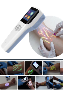 Scanner de Veias-AMA VN-3000